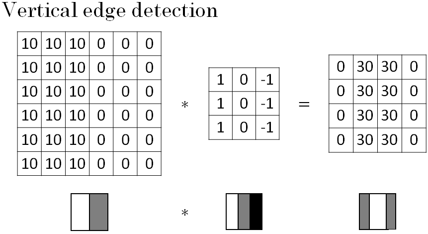 convolution-operation vertical-edge-detector